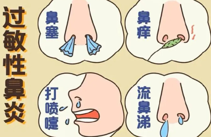 得了鼻炎多久会癌变 image-12.png