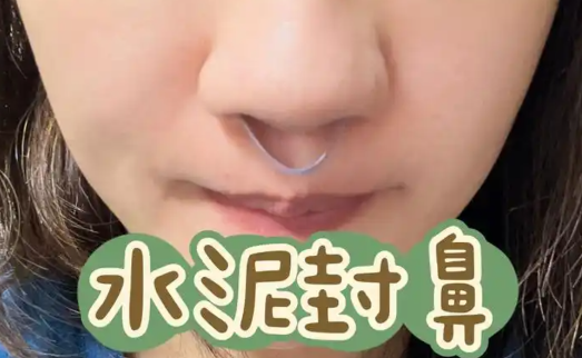水泥封鼻有多难受,鼻炎的人才知道? image-11.png
