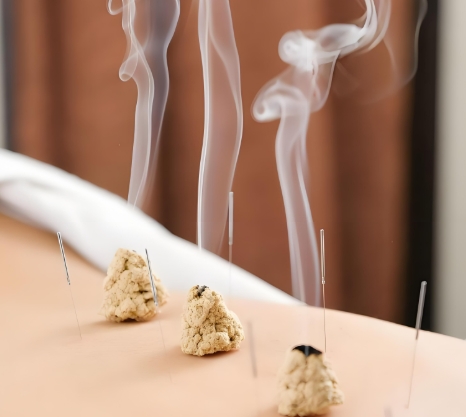 艾灸可以治疗鼻炎吗? 002.jpg